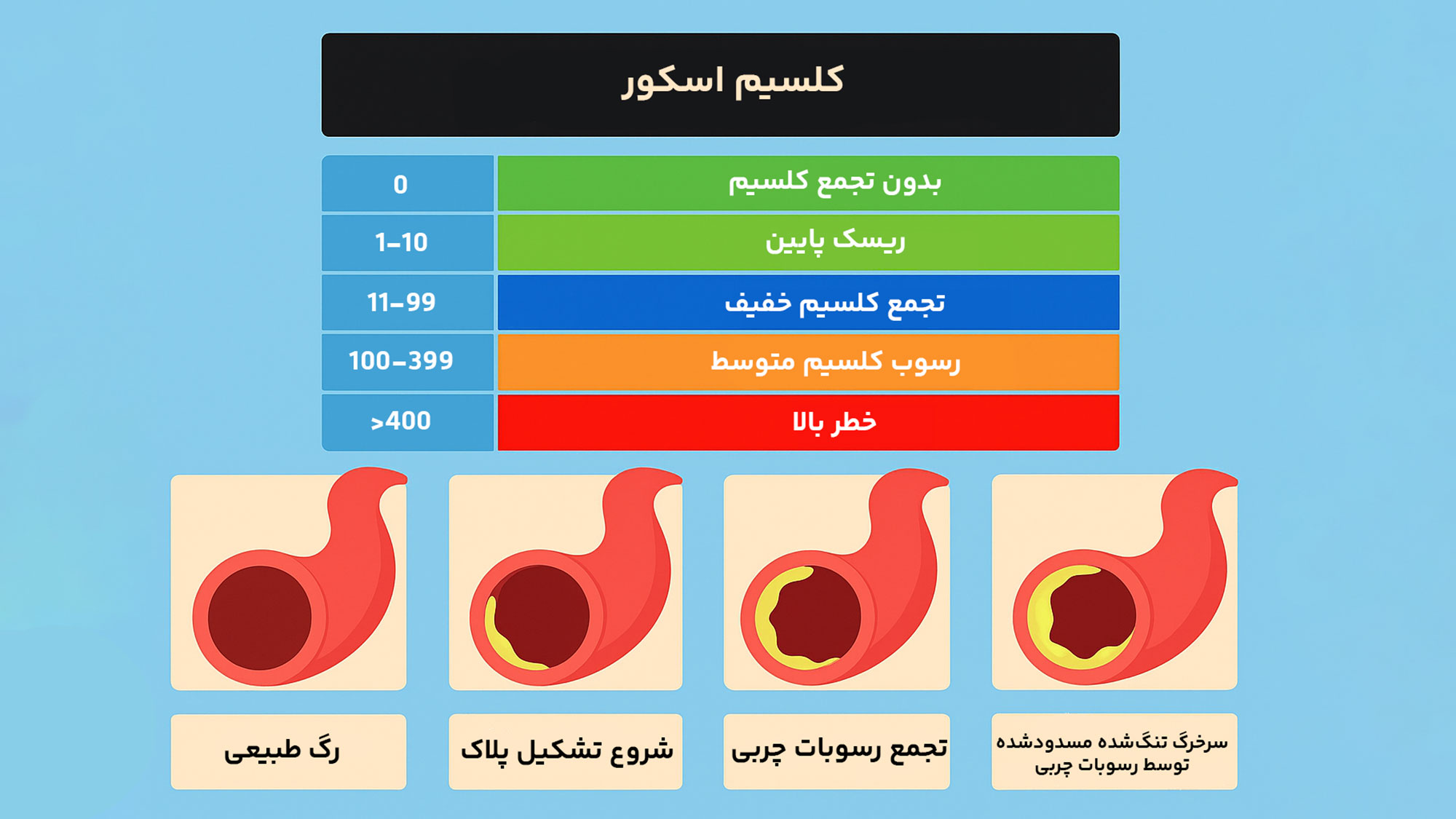 اینفوگرافیک اسکور کلسیم
